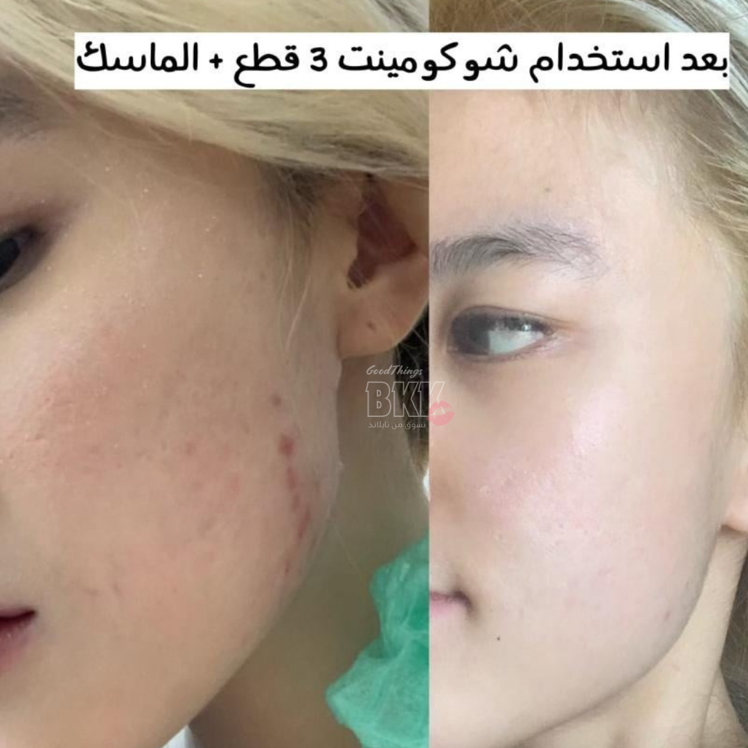 Chocolate Mint Ice Cream Anti Acne Soap صابون شوكو مينت – آيس كريم الشوكولاتة والنعناع (حجم السفر) Goodthings.bkk
