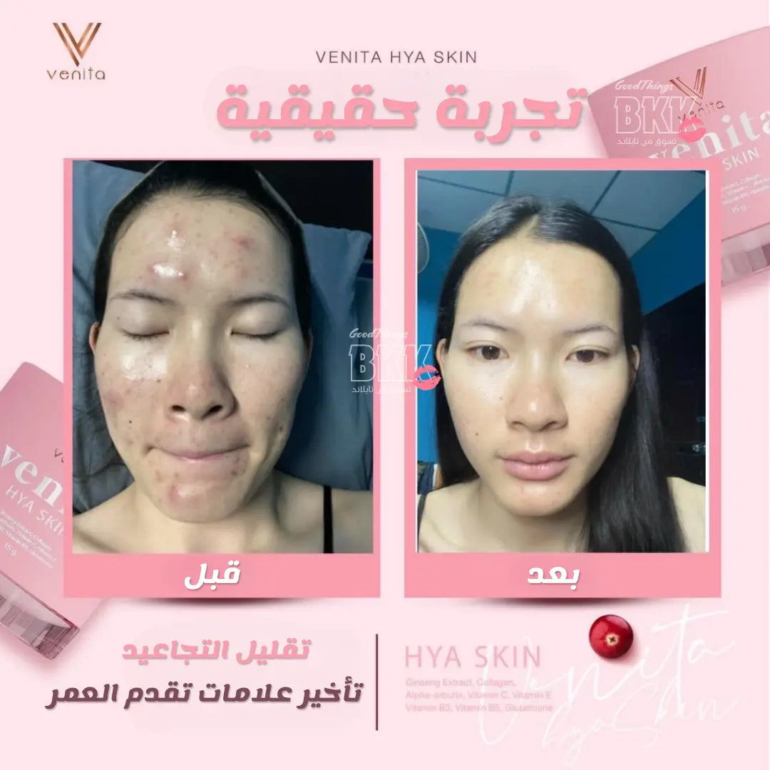 كريم فينيتا هايا السحري - Goodthings.bkk