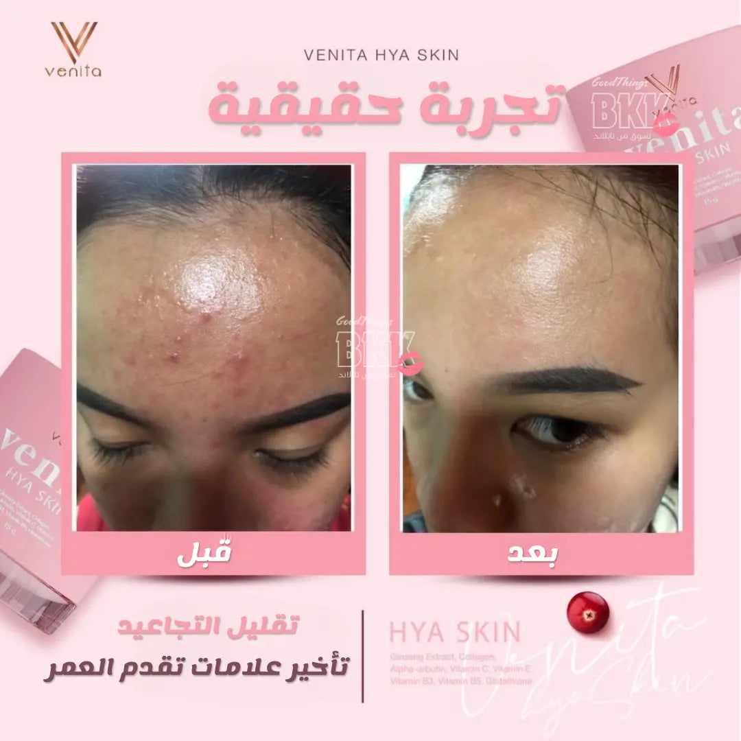 كريم فينيتا هايا السحري - Goodthings.bkk