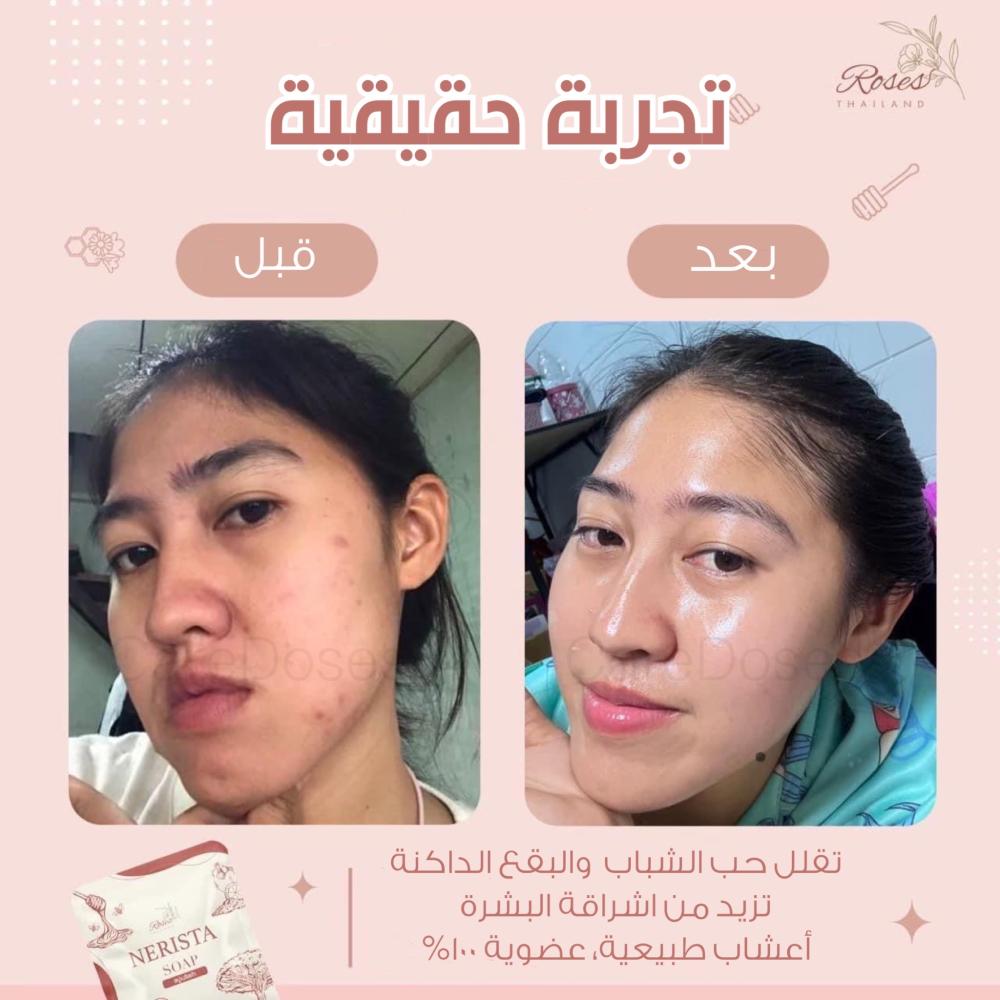 صابون نيريستا