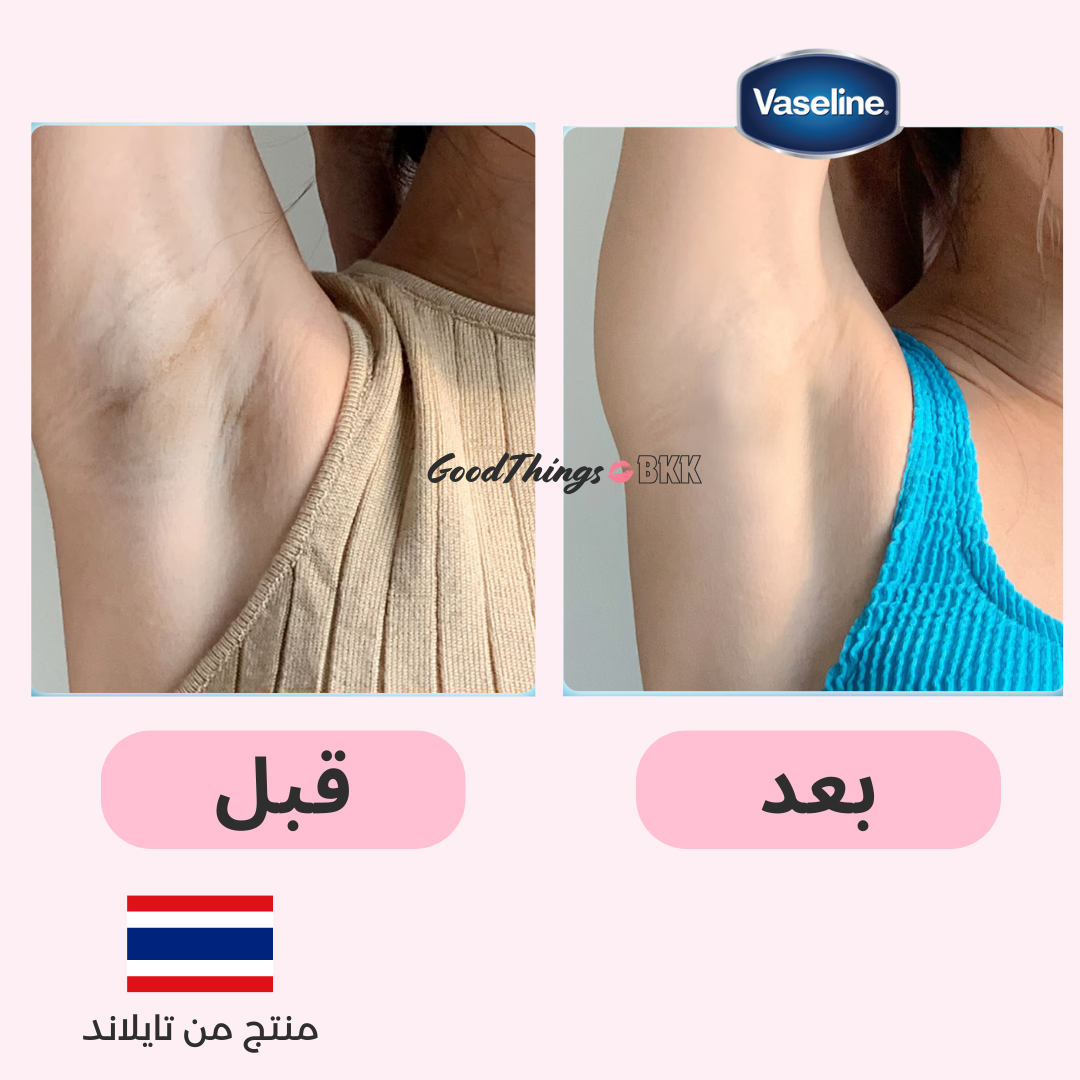 "مزيل العرق فازلين دراي سيروم غلوتا جلو أمبول ألترا برايت 45 مل، مزيل عرق متطور بتقنية غلوتا جلو لتفتيح الإبط وحماية تدوم 48 ساعة، معبأ بتصميم أنيق على خلفية بيضاء."
نايس ون
امازون