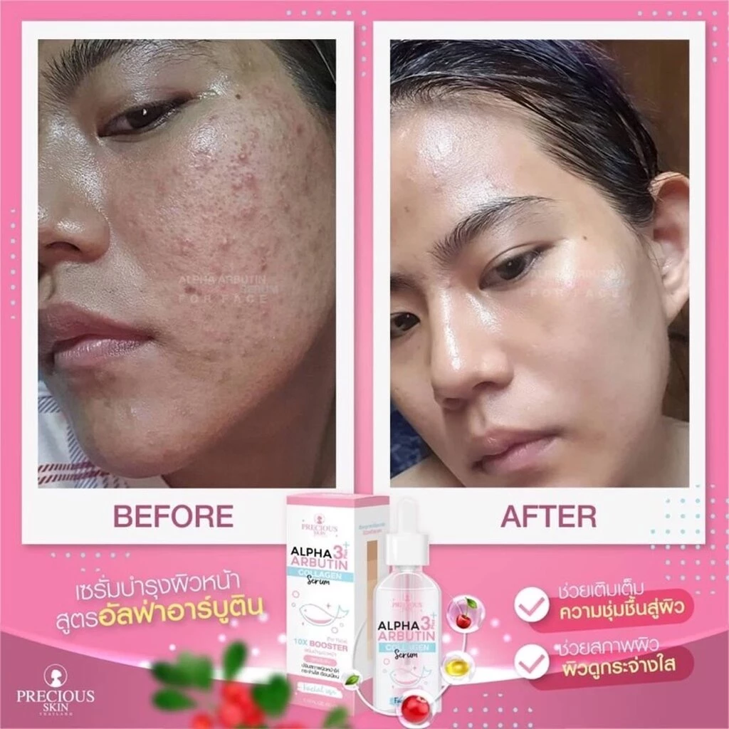 Alpha Arbutin Collagen Booster سيروم بريشيوس سكين Goodthings.bkk