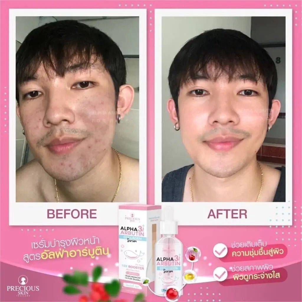 Alpha Arbutin Collagen Booster سيروم بريشيوس سكين Goodthings.bkk