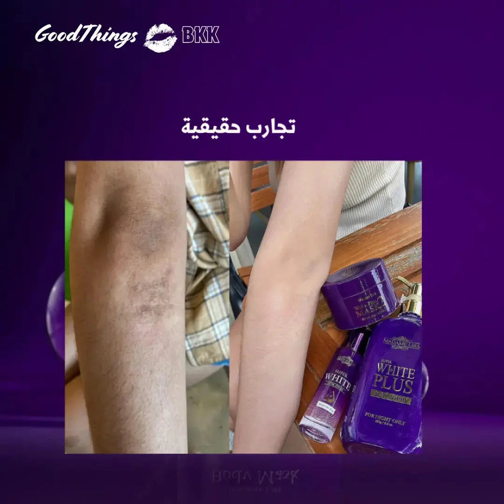 "ماسك التفتيح مدام ليزا وايت بلس 80 جم، ماسك للوجه مصمم لتحسين لون البشرة وإشراقتها، معبأ بتصميم أنيق على خلفية بيضاء."
نايس ون
امازون
