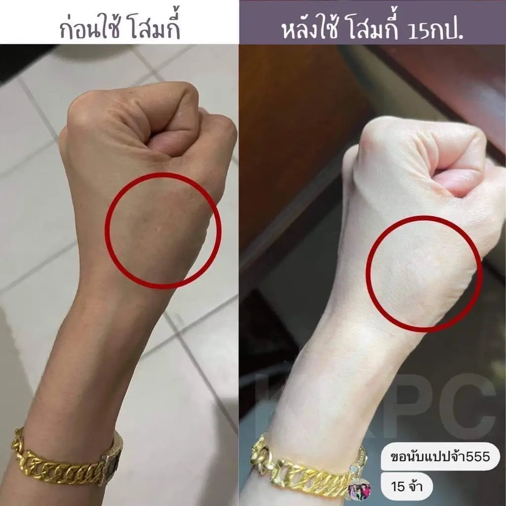 KIKEYPC Ginseng White Cream كريم الجينسنغ الأبيض المركز لتفتيح الجسم وإزالة البقع | (100 جم) Goodthings.bkk