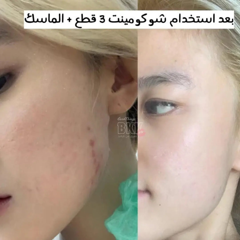 Chocolate Mint Ice Cream Anti Acne Soap صابون شوكو مينت – آيس كريم الشوكولاتة والنعناع (حجم السفر) Goodthings.bkk