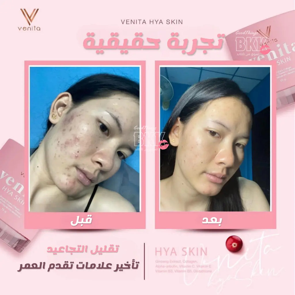 كريم فينيتا هايا السحري - Goodthings.bkk