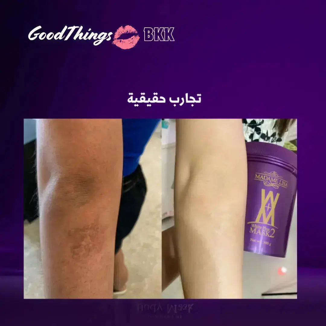 مجموعة مدام ليزا للتبييض المركز | تبييض مضاعف وعناية فائقة Goodthings.bkk