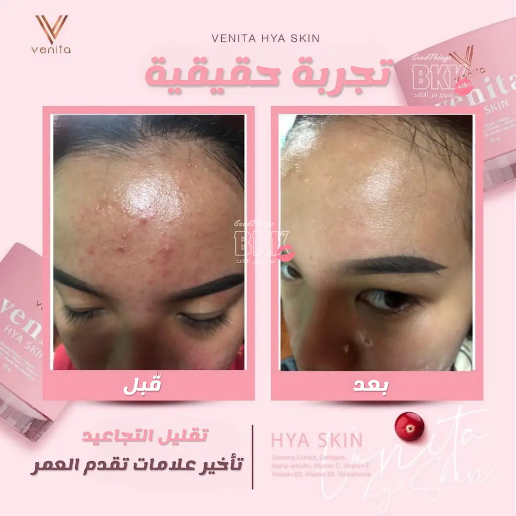 كريم فينيتا هايا السحري - Goodthings.bkk