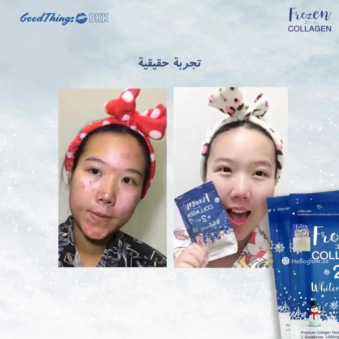 فروزن كبسولات الكولاجين للتبييض 2 في 1 - Goodthings.bkk