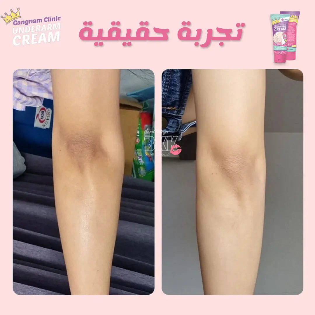 كريم غانغنام كلينك لتفتيح وتنعيم الإبط 30 جم - Goodthings.bkk