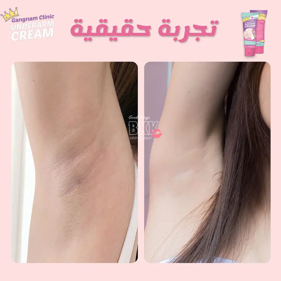 كريم غانغنام كلينك لتفتيح وتنعيم الإبط 30 جم - Goodthings.bkk