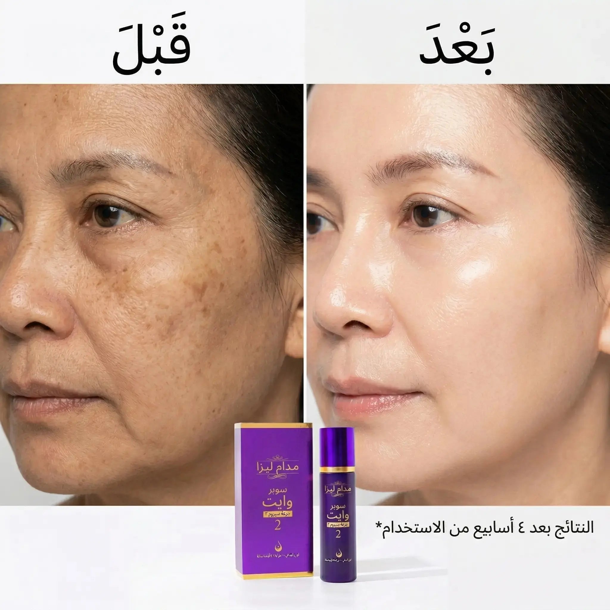 Before and after comparison of a woman's face with a skincare product packaging.