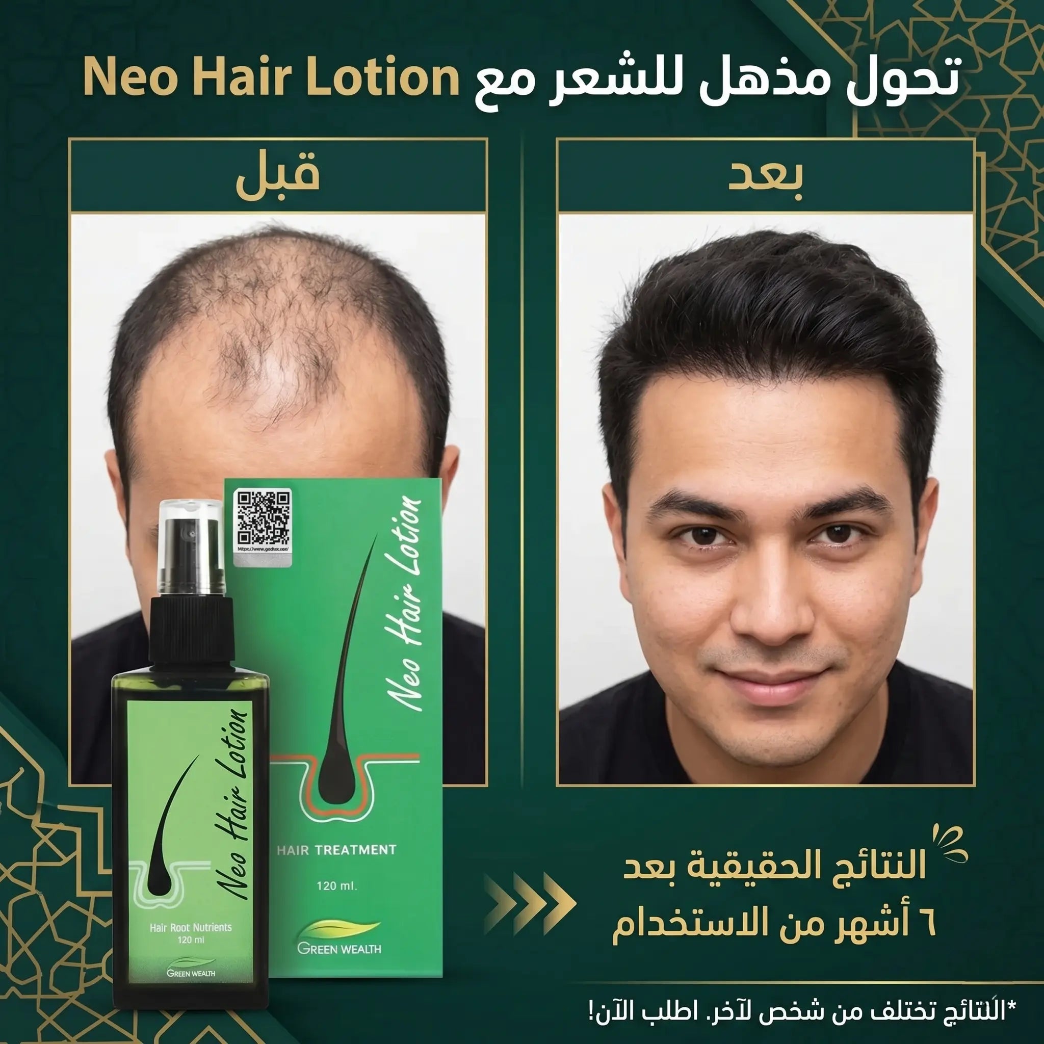 (Neo Hair Lotion) لوشن نيو هير الأصلي لعلاج تساقط الشعر | بخاخ تايلاندي مكثف - 120 مل Goodthings.bkk