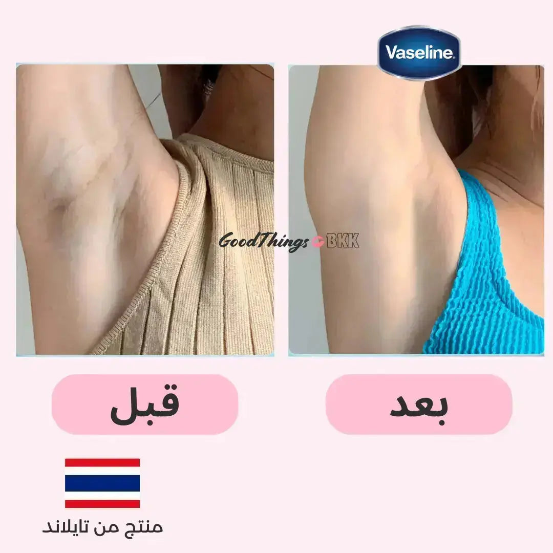 "مزيل العرق فازلين دراي سيروم غلوتا جلو أمبول ألترا برايت 45 مل، مزيل عرق متطور بتقنية غلوتا جلو لتفتيح الإبط وحماية تدوم 48 ساعة، معبأ بتصميم أنيق على خلفية بيضاء."
نايس ون
امازون
