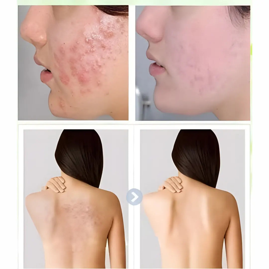 MERRY BELL Herbal Soap (160 جم) - صابونة ميري بيل العشبية Goodthings.bkk