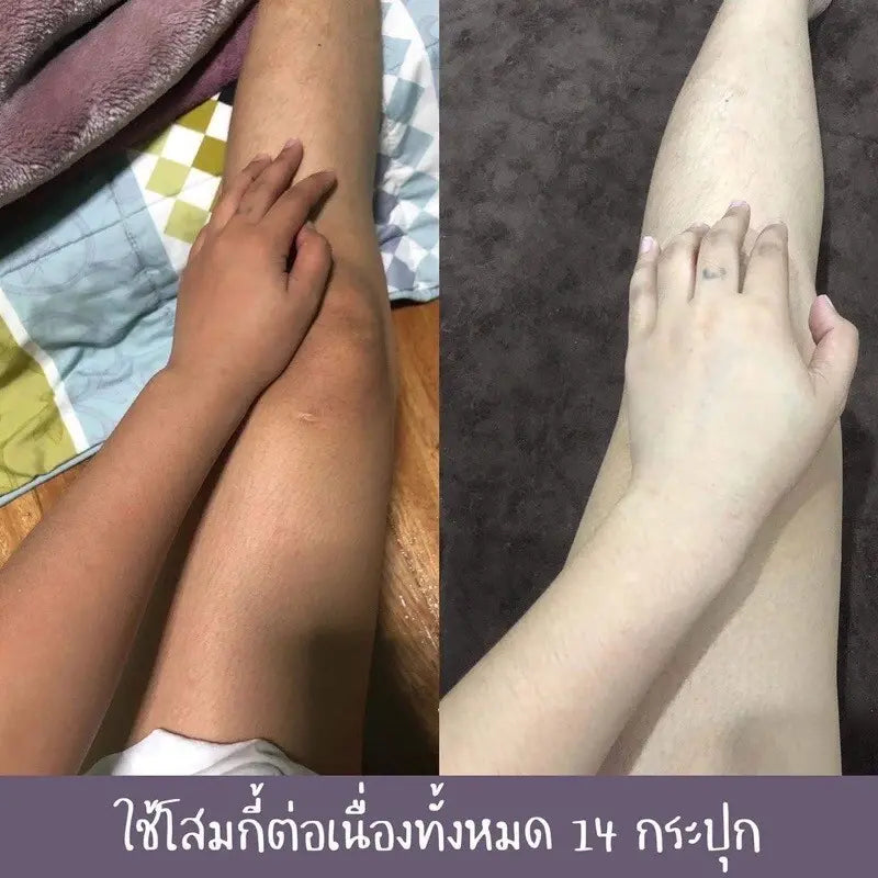 Before and after comparison of legs with a hand on a checkered fabric background.