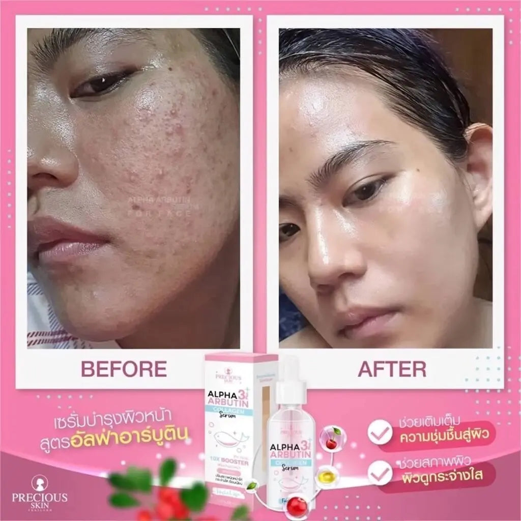 Alpha Arbutin Collagen Booster سيروم بريشيوس سكين Goodthings.bkk