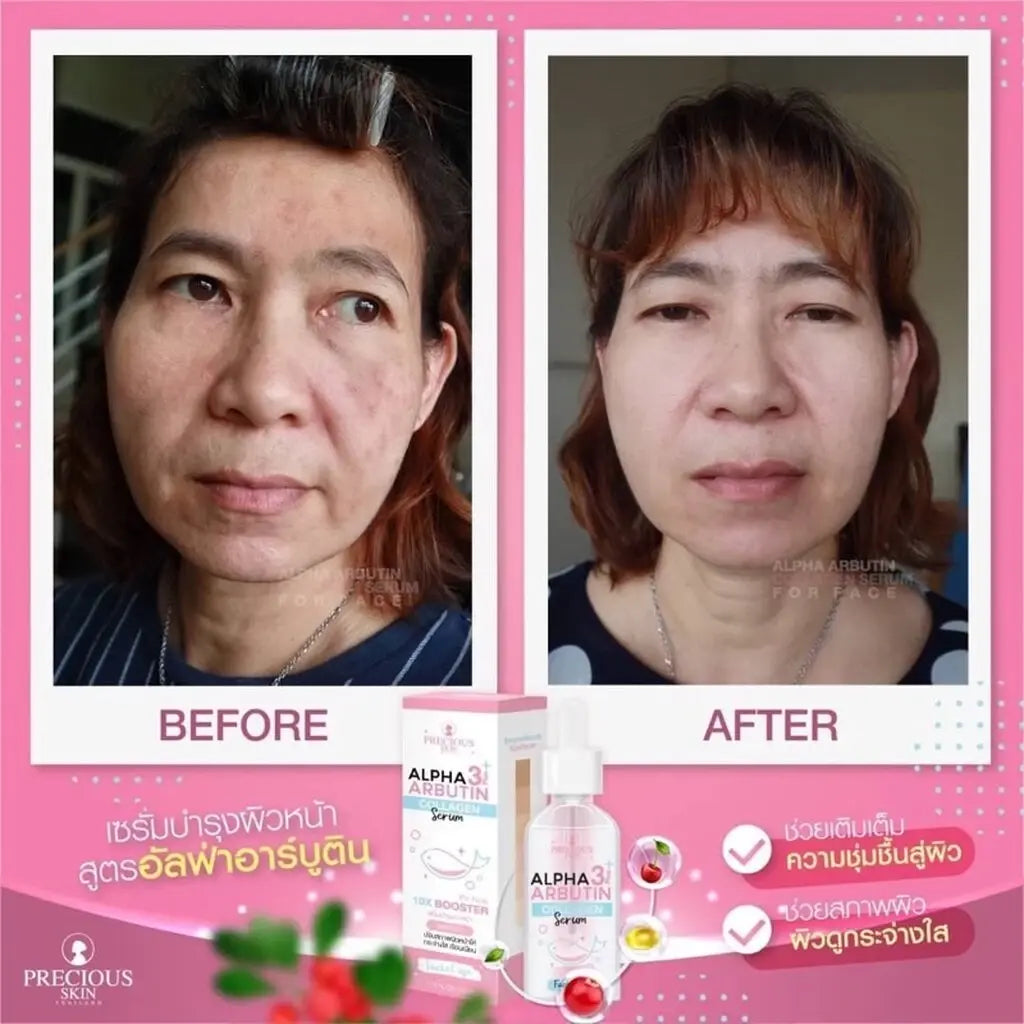 Alpha Arbutin Collagen Booster سيروم بريشيوس سكين Goodthings.bkk