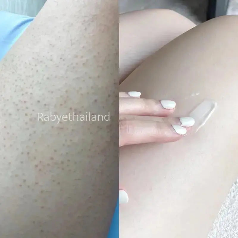 (Rabye) معالج رابي ببروتين الحليب والعسل | لعلاج جلد الدجاجة والبقع الداكنة - 450 مل Goodthings.bkk