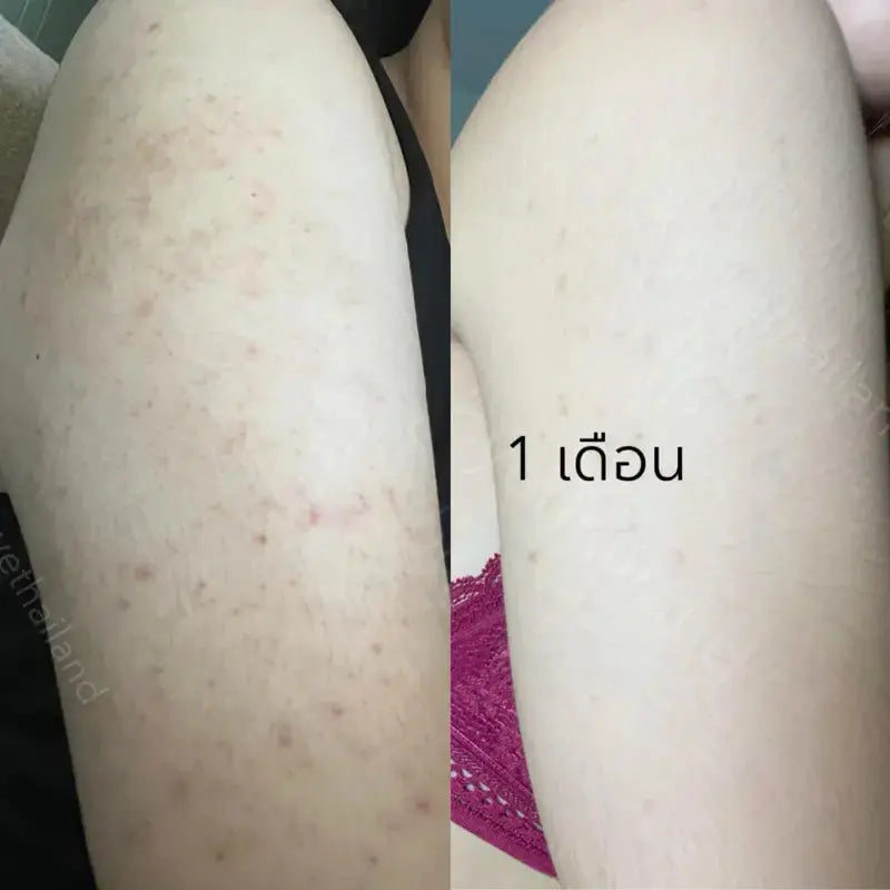 (Rabye) معالج رابي ببروتين الحليب والعسل | لعلاج جلد الدجاجة والبقع الداكنة - 450 مل Goodthings.bkk