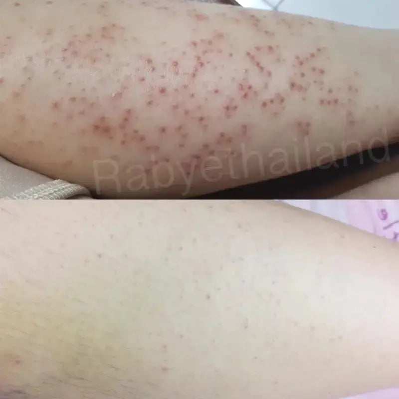 (Rabye) معالج رابي ببروتين الحليب والعسل | لعلاج جلد الدجاجة والبقع الداكنة - 450 مل Goodthings.bkk